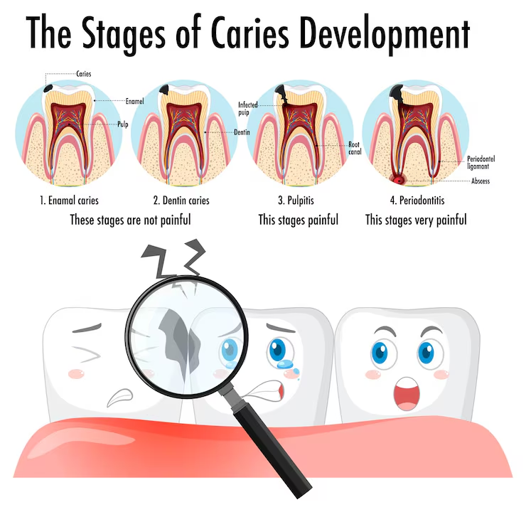 what is cavity?
